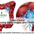 Best Hospital For Colon Cancer