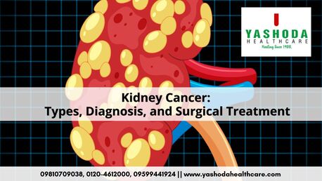 Ghaziabad, Health, Best Hospital For Kidney Cancer
