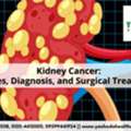 Best Hospital For Kidney Cancer
