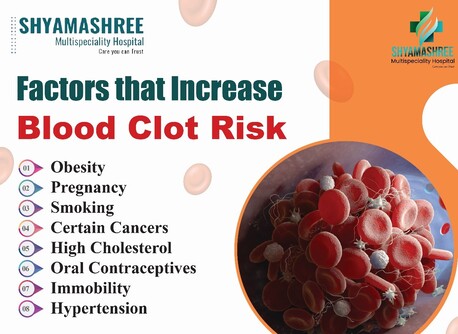 Mumbai, Health, Blood Clot Risk | Best Multispecialty Hospital In Puri | Shyamashree
