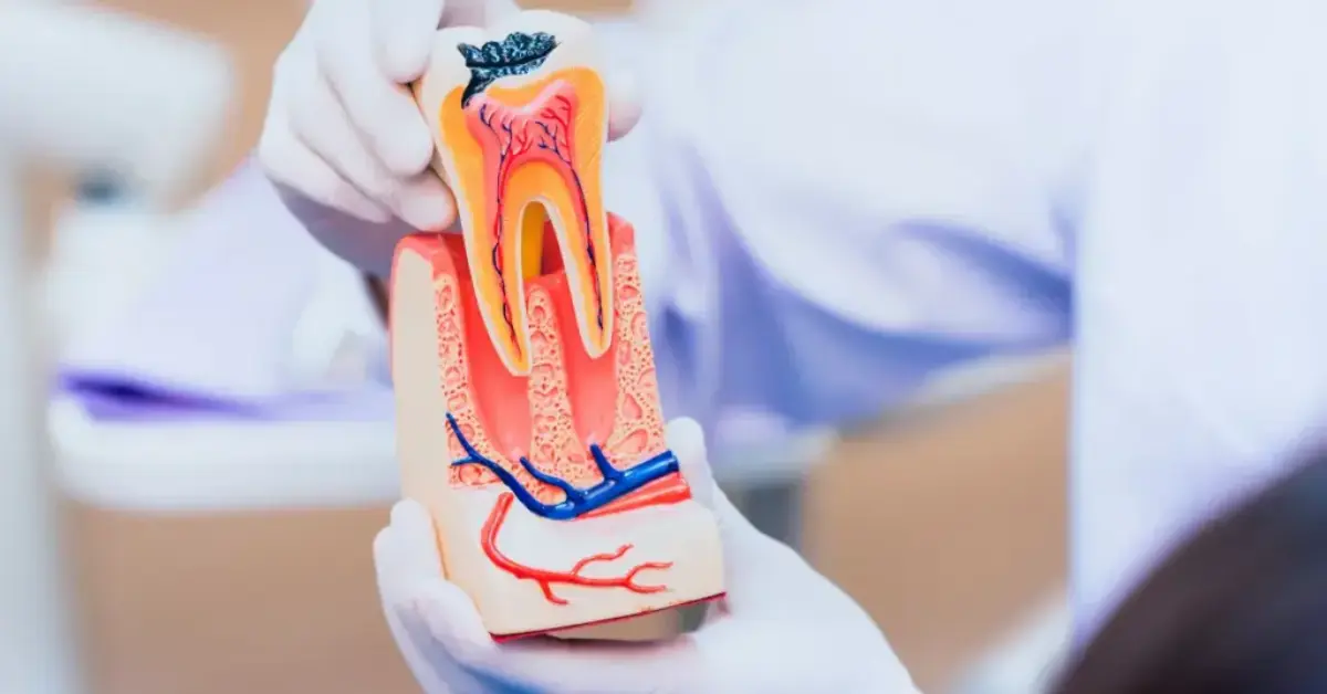Mumbai, Dental, Root Canal Treatment In Dombivli