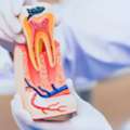 Root Canal Treatment In Dombivli
