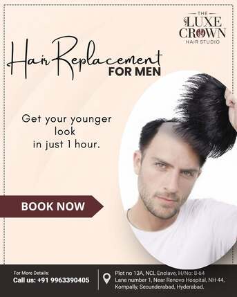 Hyderabad, Health, Best Hair Extensions In Kompally
