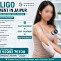 INR 5000,  Effective Vitiligo Treatment In Jaipur For White Patches On Skin