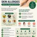 Trusted Specialist For Acute & Chronic Skin Allergies - Dr. Mouna HN