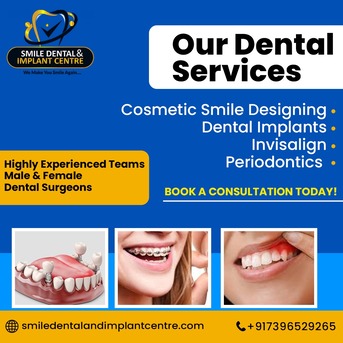 Hyderabad, Dental, BEST DENTAL HOSPITAL IN SECUNDERABAD