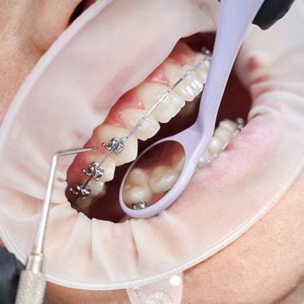 Kabul, Dental, Luxury Smile Makeovers In Kerala For Radiant Aesthetic Perfection
