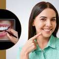 Cosmetic Smile Designing In East Delhi
