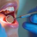 Advanced Mouth Cancer Treatment In Delhi