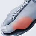 Toe-Tal Relief: A Journey Through Bunion Surgery Types