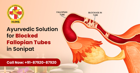 Mumbai, Health, Ayurvedic Solution For Blocked Fallopian Tubes In Sonipat