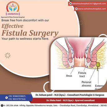 Ahmedabad, Health, End Fistula Discomfort With Advanced Treatment