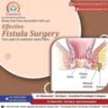 End Fistula Discomfort With Advanced Treatment