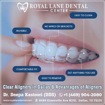Dallas, Dental, Clear Aligners In Dallas