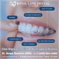 Clear Aligners In Dallas