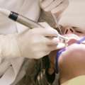 Advanced Laser Solution For Modern Gum Care