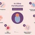 IVF Treatment In Delhi - Dr Rhythm Gupta