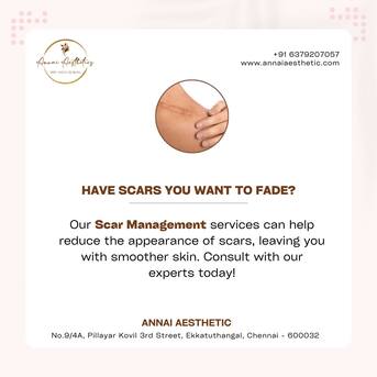 Chennai, Health, PRP Treatment Near Guindy | Hair Loss & Skin Rejuvenation &ndash; Annai Aesthetic Clinic