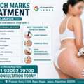 INR 3500,  Stretch Marks Treatment In Jaipur - Get Smooth Skin Today