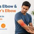 Tennis Elbow & Golfer&rsquo;s Elbow Treatment In Gurugram