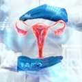 Cervical Cancer Hospital In Gurgaon