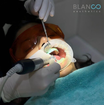 Mumbai, Business, Blanco Aesthetics Dental & Skin Studio