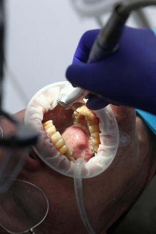 Los Angeles, Dental, Affordable Invisalign Aligners In Agoura Hills &mdash; Agoura Advanced Dentistry Has Got You Cov