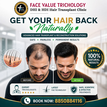 Chennai, Legal, Get Your Hair Back Naturally | Advanced Hair Transplant In Chennai