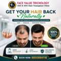 Get Your Hair Back Naturally | Advanced Hair Transplant In Chennai