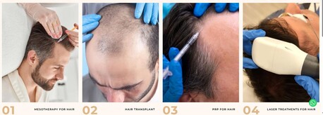 Ghaziabad, Health, Hair Treatments In Ghaziabad