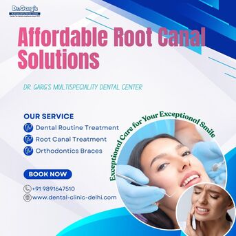 New Delhi, Health, Affordable Root Canal Solutions At Dr. Garg&rsquo;s Multispeciality Dental Center