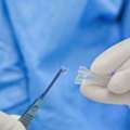 Lens Replacement Surgery For Clear Vision | EyeOC