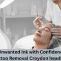 Remove Unwanted Ink With Confidence &ndash; Laser Tattoo Removal Croydon