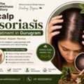 Expert Scalp Psoriasis Treatment In Gurugram | Wellness Story