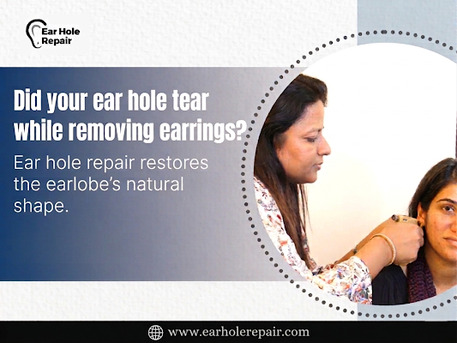 Mumbai, Health, Did Your Ear Hole Tear While Removing Earrings?
