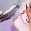 Emergency Dental Clinic In Mississauga