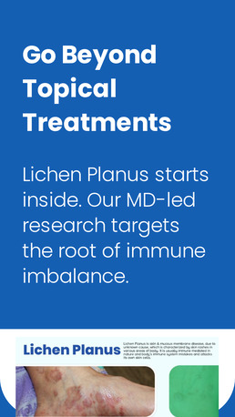 Faridabad, Health, Homeopathy Treatment For Lichen Plannus