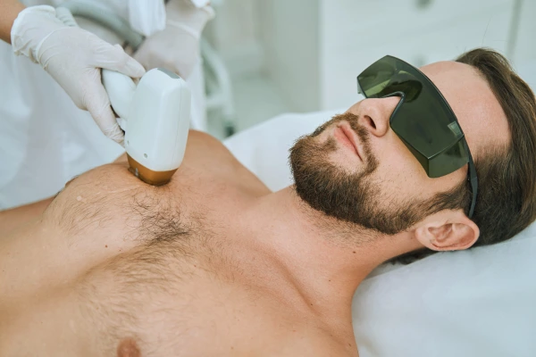 Houston, Health, Laser Hair Removal Houston TX For Smooth Skin