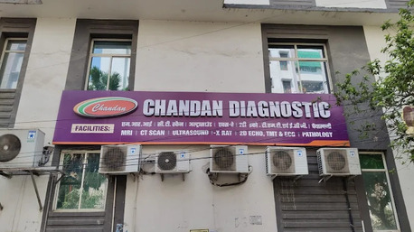 Lucknow, Health, ECG Test In Lucknow - Chandan Diagnostic Lucknow