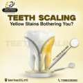 Say Goodbye To Yellow Stains: Why You Need Teeth Scaling
