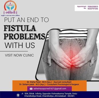 Ahmedabad, Health, Gentle & Effective Kshar Sutra Treatment In Ahmedabad At Ashwinau Hospital