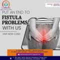 Gentle & Effective Kshar Sutra Treatment In Ahmedabad At Ashwinau Hospital