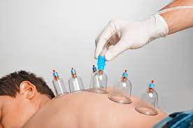Riyadh, Creative, Hijama (Cupping Therapy)
