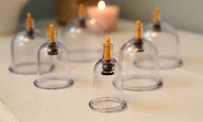 Riyadh, Creative, Hijama (Cupping Therapy)