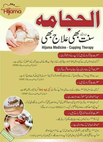 Riyadh, Creative, Hijama (Cupping Therapy)