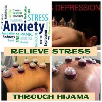 Riyadh, Sporting Goods, SAR 200,  Hijama - The Best Treatment For Cleansing Your Body & Soul.