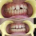 Expert Dentist Near Sector 19 Dwarka For Implants & Root Canal