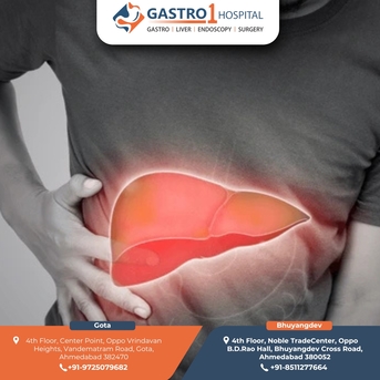 Ahmedabad, Health, Trusted Liver Transplant Solutions With Dr. Ruchir Patel