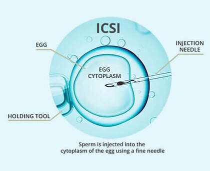 New Delhi, Health, ICSI Treatment In Delhi - Dr Rhythm Gupta
