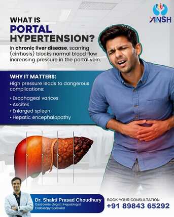 Bhubaneswar, Health, Portal Hypertension Care | Best Gastroenterologist In Bhubaneswar | Dr. Shakti Prasad Chou